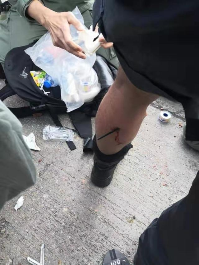 墨西哥射箭队员意外带走金牌，反击强敌的简单介绍